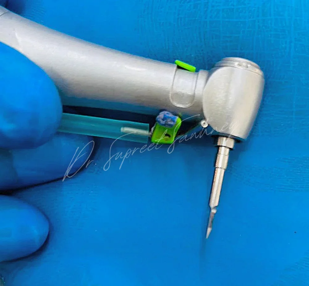 Contra-angle handpiece fitted with a pilot drill for implant osteotomy preparation